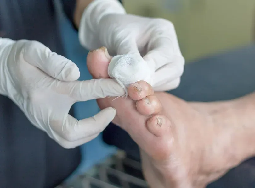 img Objetivo de la prevención 01